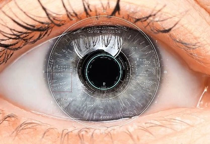 Иридодиагностика