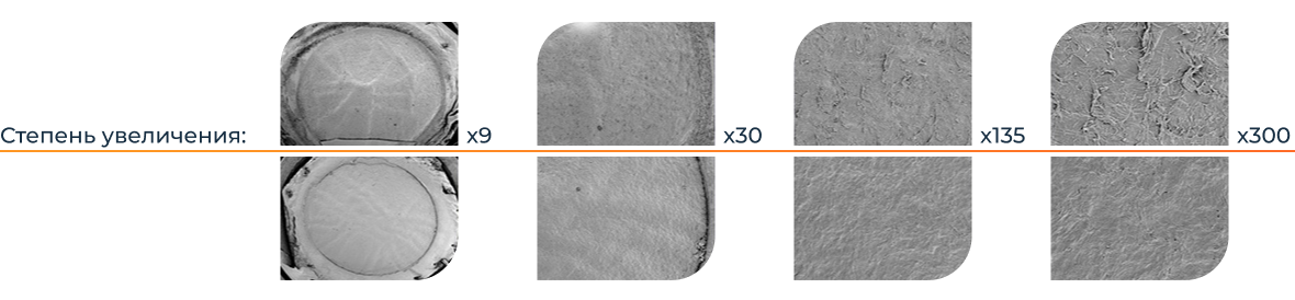 срез микрокератома и фемтосекундного лазера