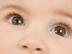 врожденная глаукома врожденная глаукома