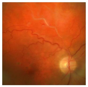 Индивидуальный подход