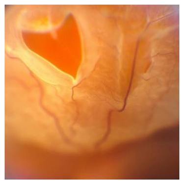 Опытные врачи-ретонологи