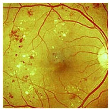 Опытные врачи-ретонологи