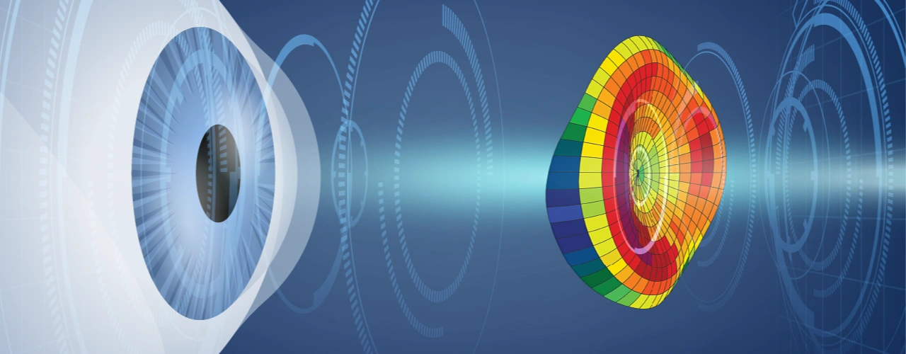 коррекция зрения суперласик